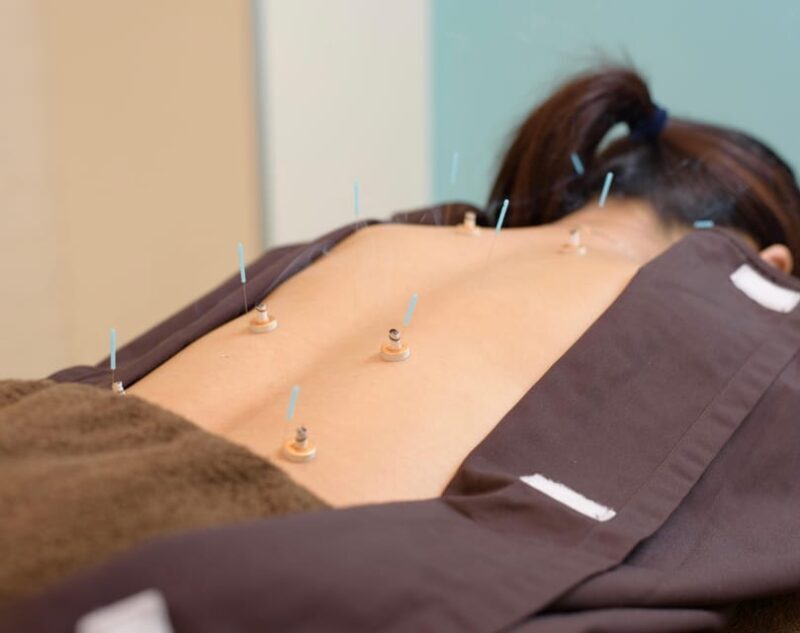 Hiroshima: Acupuncture and Japanese unique massage treatment - Authenticity and Quality