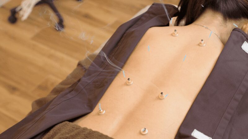 Hiroshima: Acupuncture and Japanese unique massage treatment - FAQ